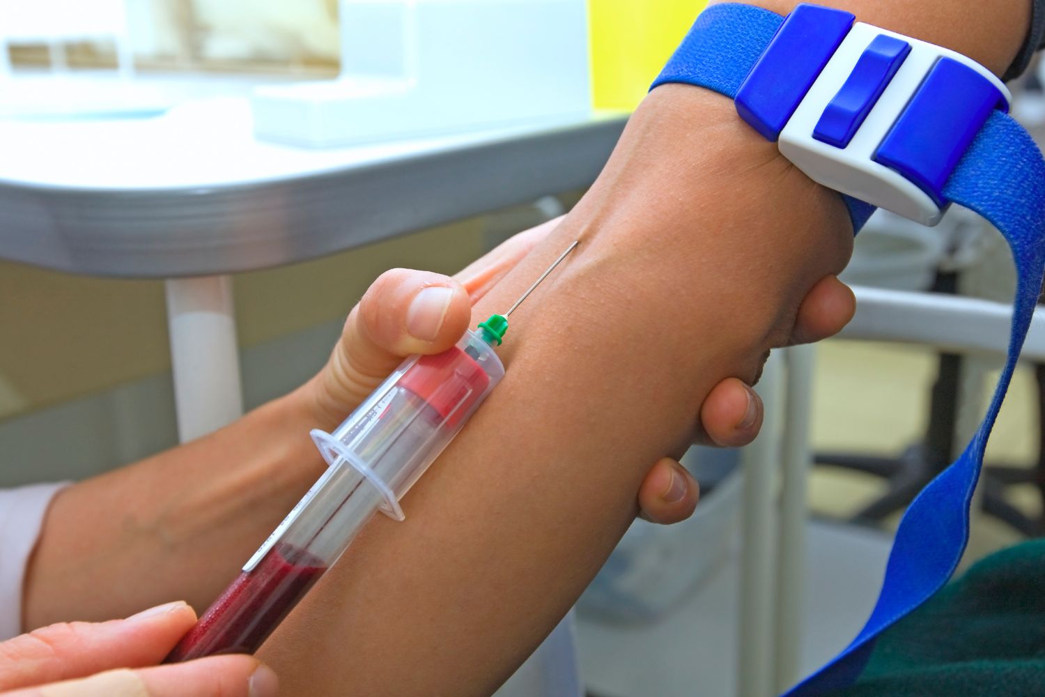 Анализ крови фибротест на гепатит с